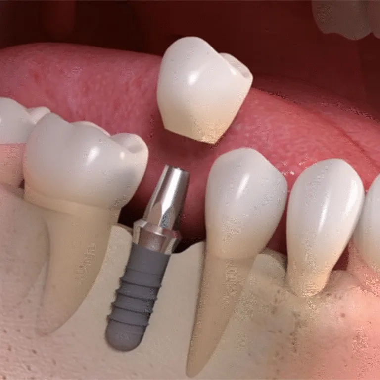 Exploring Different Types of Dental Clinic Services in Dubai 6 Untitled-design-2025-02-17T190451.140-1