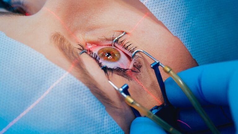 Eye Surgeon Dubai: Informative Overview of Eye Procedures 1 femto-lasik-1300x731-4