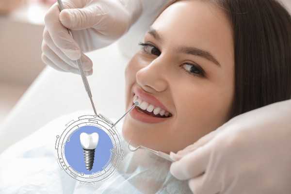  dental implants Nantwich 